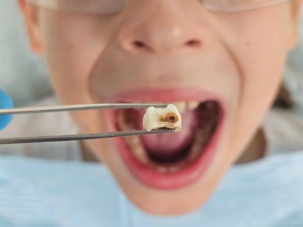 Best Emergency Pediatric Dental Care in Belzoni, MS